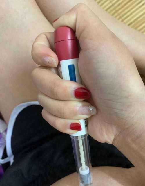 试管婴儿卵泡自然排出原因与应对策略