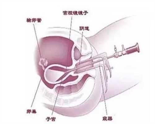 试管代怀费用-子宫内膜薄最佳5种治疗方式